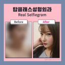 탑성형외과의원 이미지