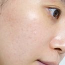 ㈜디 앤 에이 | 피부 속 건조 잡는 미백 앰플 추천, V&amp;A뷰티 광채앰플