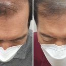 고은하늘성형외과의원 네이버블로그