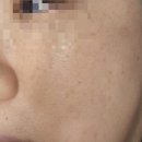석산로 | 인천 간석동 피부 관리 케이속건조 피부연구소 후기
