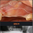 수플란트치과병원 이미지