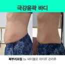 뷰티비젼