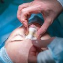 필이비인후과의원 | 디테일이 만드는 차이, 도자기 의원에서 만나는 코성형