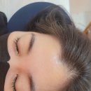 희헤어라인 이미지