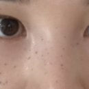 벨포인트의원 네이버블로그