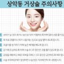 에스프라임 이미지