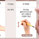 나이 들어 떨리는 손… 파킨슨병 vs 수전증 이미지