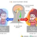 갑상선기능저하증 갑상선저하증 원인 예방 이미지