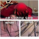 수원 지루성 탈모 두피관리샵 | 두피밥에서 1회 관리로 느낀 솔직후기