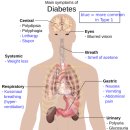 보훈크린 | 위, 대장 수면 내시경 10시간 전부터 먹는 약 총 5리터를 절반씩 1~2회 중 2회 약물 모두 토하다!
