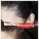헤라헤어라인