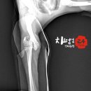 [골절 수술] - 피부절개후 관절낭 절개x humerus condyle fx 골절 수술 이미지