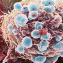 ﻿Cancer is not just 'bad luck' but down to environment, study suggests 이미지