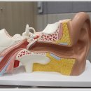 부천연세보청기 이미지