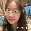 명동역(4) | 명동역피부과 피코슈어 토닝 레이저 효과 후기