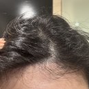 한지제 | 두피 각질 원인 집중 관리한지 한달차 후기