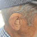 밀양보청기 밀양서울보청기 산내면에 거주하시는 아버님, 귓속형 보청기 착용 후기입니다.