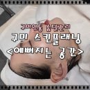 SS마트인동점 | 구미 인동 솜털관리 <예뻐지는 공간> 스킨플래닝으로 예뻐지자!! 스킨플래닝에 대한 정보 총 정리!!