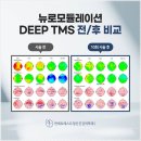 서울TMS