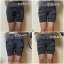 이젠의원 | 상상 속 다리라인을 현실로 만들어주는 그 곳! 지방분해주사의원 내돈내산 솔직후기 4탄