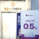 운정성형외과 실리프팅과 콧볼축소술 효과를 동시에! 청담스킨성형외과 후기 남겨요!