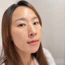 제이씨메디칼 | 메디컬오 압구정 탄력 실리프팅 효과 피부과관리 팔자주름 전후