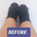 신라주유소 | 공덕역 마포체형교정 웰카이로모션에서 한 번만에 효과체감하고 바로 6회권 결제한 후기 (비포/애프터)