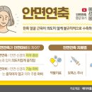 눈·입주위 떨리는 얼굴경련.. 왜 생길까? 이미지