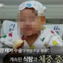 식욕억제 힘든 질환, 로하드 증후군 이미지