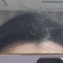 더다른