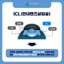 동그라미 안경 콘택트 이미지