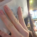 가좌엘리트치과의원 | 20대 후반, 사랑니 4개 발치 후기 (신촌 이하루치과의원)