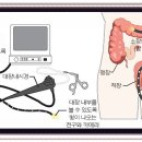 대장 속이 궁금하시죠? 대장내시경 체험기.. 들어갑니다.. 이미지