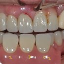 참치과기공소 이미지