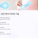 (주)씨니즈엔터테인먼트 | 비용은 비슷, 효과는 다르다? 울쎄라와 써마지 리얼 비교