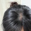 아씨헤어라인 이미지