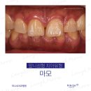 미니쉬치과병원 이미지