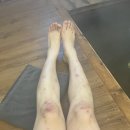 편백 해수탕 사우나 | 건선 치료에 좋은 영종도 해수탕 솔밭 해수방 후기