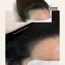 모델헤어라인 이미지