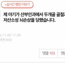 제 아기가 산부인과에서 두개골 골절과 뇌출혈, 저산소성 뇌손상을 당했습니다. 이미지