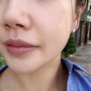 큐사랑북구대천로점 | 광주 문흥동 피부관리 선피부관리 안면유지인대거상윤곽관리 비대칭관리 후기