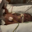 강릉아산병원 이미지