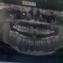 성성N하나치과의원 이미지