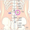 혈도