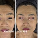 JY 메디칼 이미지