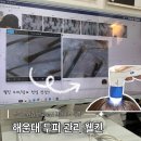 센텀동로 | 해운대두피 관리 웰킨두피탈모센터 케어 후기