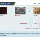 쯔쯔가무시증에 대한 안내 이미지