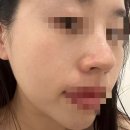 진에스테틱 이미지