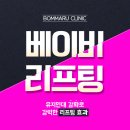 봄마루 | [실루엣소프트후기] 봄마루클리닉 베이비리프팅 후기