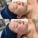 미남이네 | 강서동피부관리실 추천 청춘미남 CCMN 솔직후기